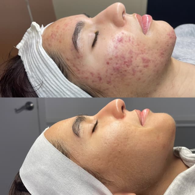 GLOW 101 MEMBERSHIP at Resilience in Knoxville, TN